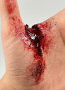 Finger wound